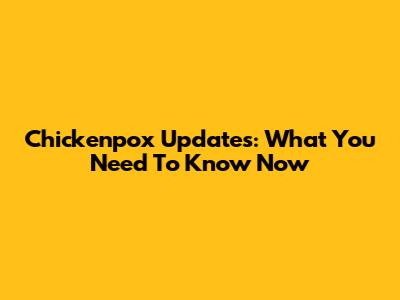 Chickenpox Updates: What You Need To Know Now