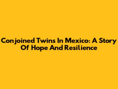 Conjoined Twins In Mexico: A Story Of Hope And Resilience