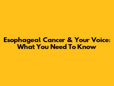 Esophageal Cancer & Your Voice: What You Need To Know