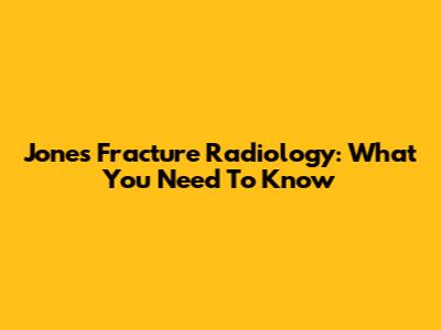 Jones Fracture Radiology: What You Need To Know