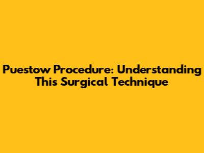 Puestow Procedure: Understanding This Surgical Technique