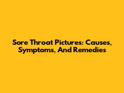 Sore Throat Pictures: Causes, Symptoms, And Remedies
