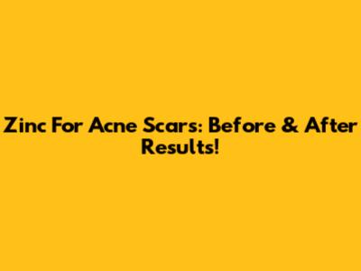 Zinc For Acne Scars: Before & After Results!